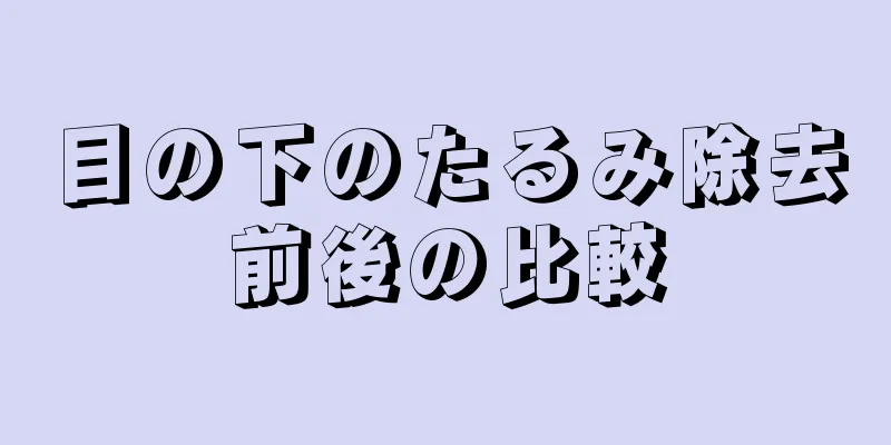 目の下のたるみ除去前後の比較