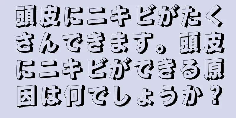 頭皮にニキビがたくさんできます。頭皮にニキビができる原因は何でしょうか？