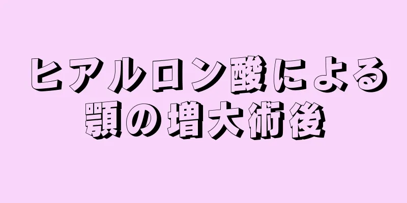 ヒアルロン酸による顎の増大術後