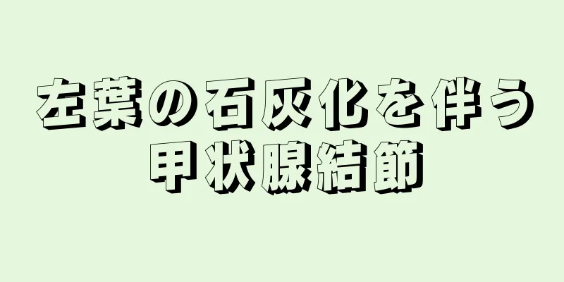 左葉の石灰化を伴う甲状腺結節