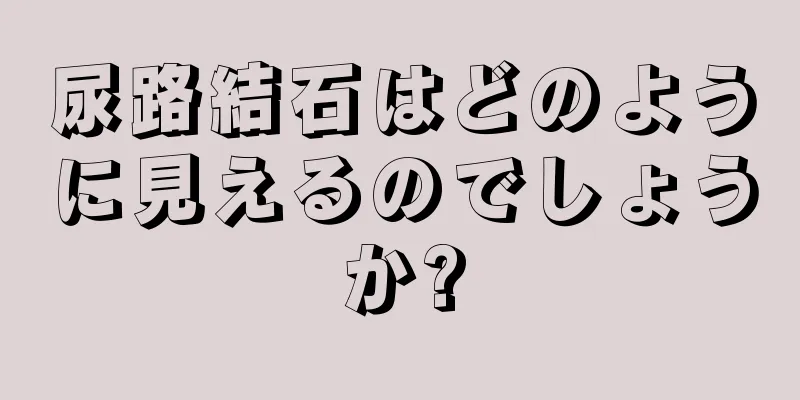 尿路結石はどのように見えるのでしょうか?