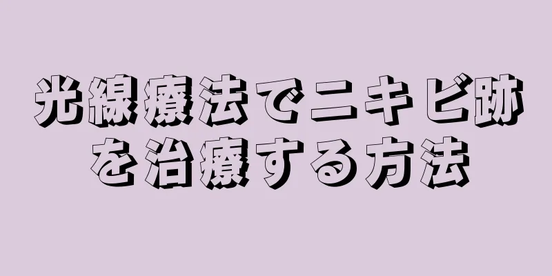 光線療法でニキビ跡を治療する方法