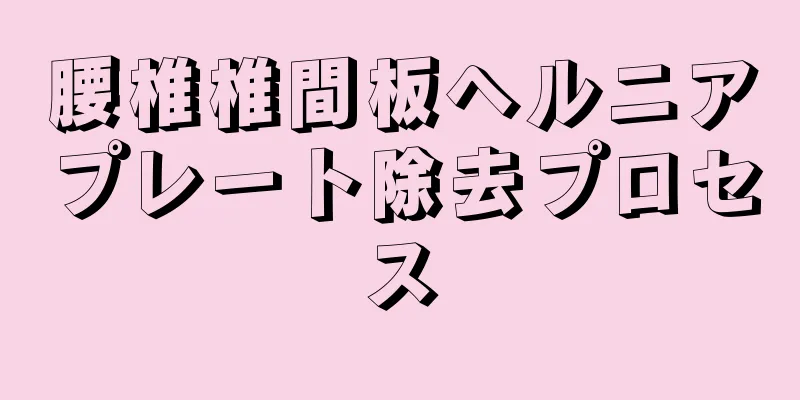 腰椎椎間板ヘルニアプレート除去プロセス