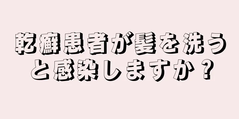 乾癬患者が髪を洗うと感染しますか？