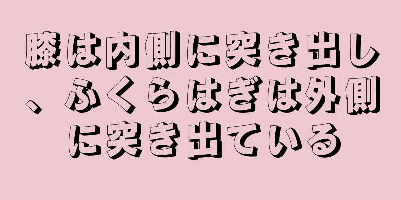 膝は内側に突き出し、ふくらはぎは外側に突き出ている