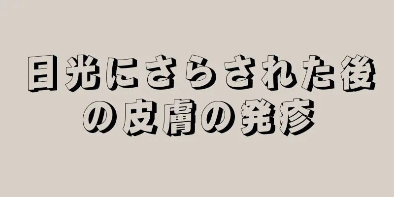 日光にさらされた後の皮膚の発疹