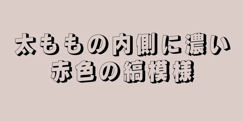 太ももの内側に濃い赤色の縞模様