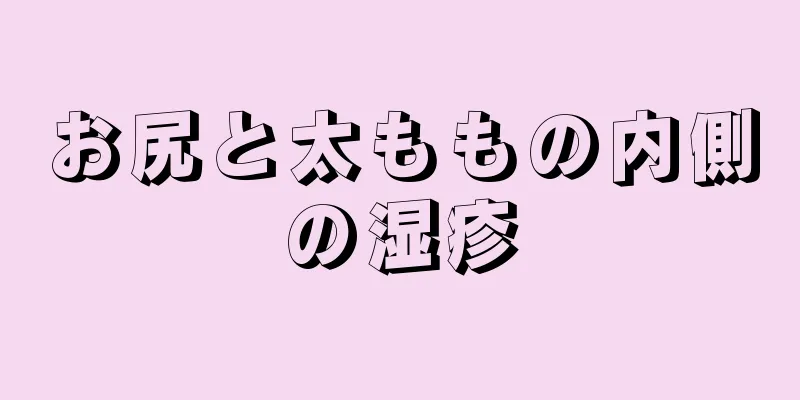 お尻と太ももの内側の湿疹