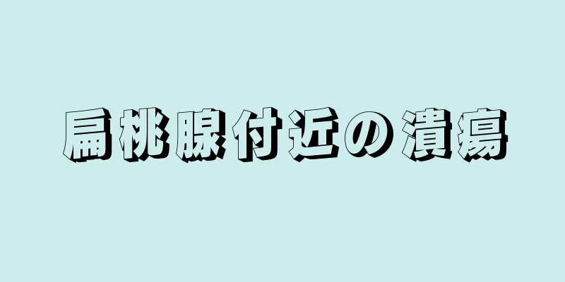 扁桃腺付近の潰瘍