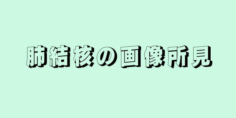 肺結核の画像所見