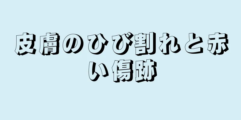 皮膚のひび割れと赤い傷跡