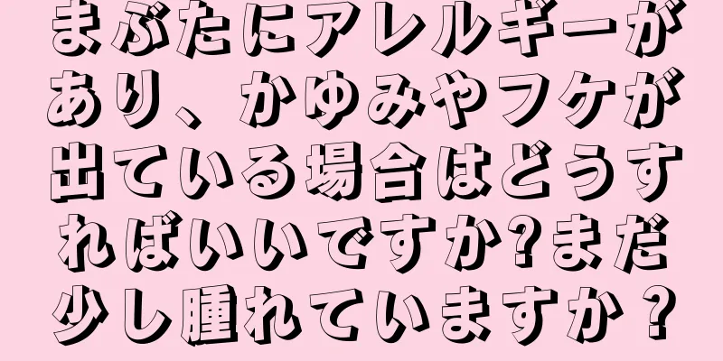 まぶたにアレルギーがあり、かゆみやフケが出ている場合はどうすればいいですか?まだ少し腫れていますか？