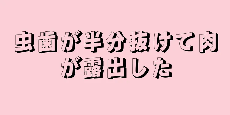 虫歯が半分抜けて肉が露出した