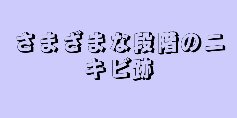 さまざまな段階のニキビ跡