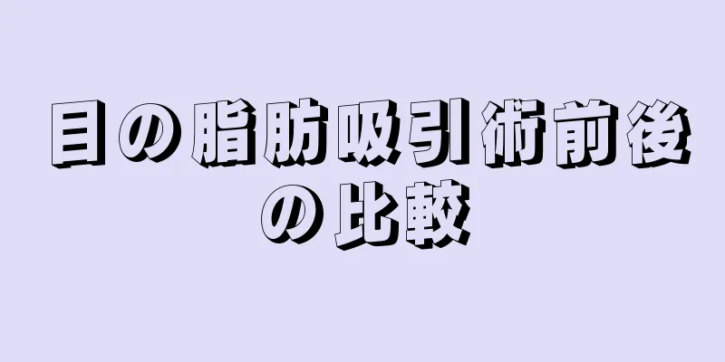 目の脂肪吸引術前後の比較