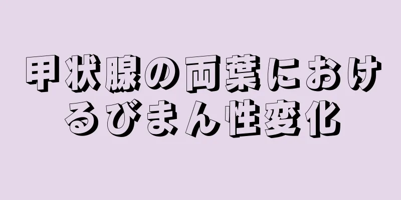 甲状腺の両葉におけるびまん性変化