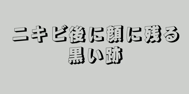 ニキビ後に顔に残る黒い跡