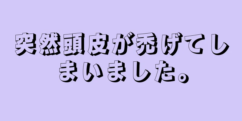 突然頭皮が禿げてしまいました。