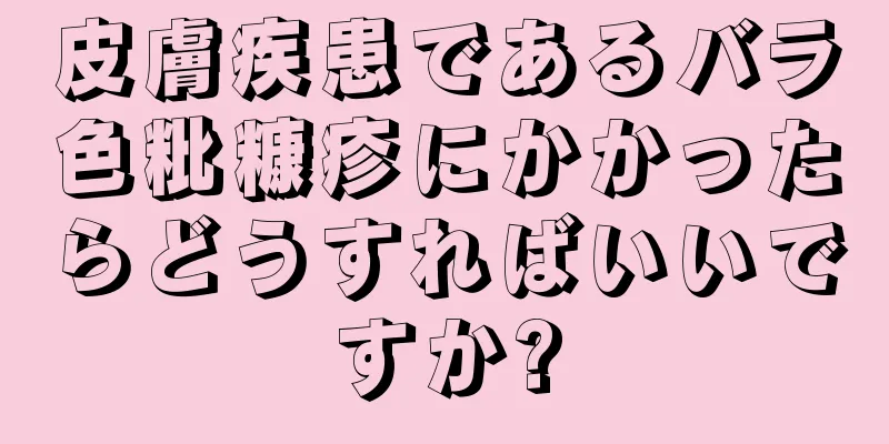 皮膚疾患であるバラ色粃糠疹にかかったらどうすればいいですか?