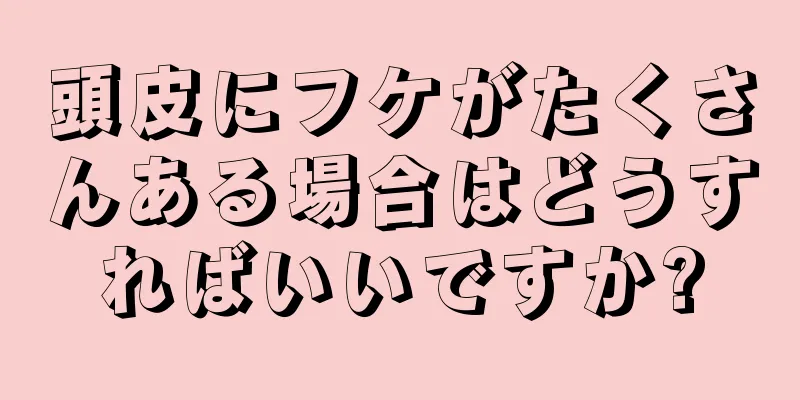 頭皮にフケがたくさんある場合はどうすればいいですか?