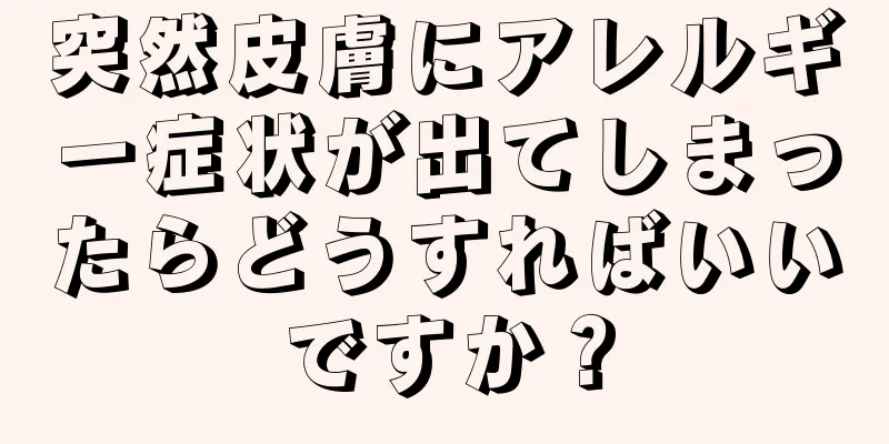 突然皮膚にアレルギー症状が出てしまったらどうすればいいですか？