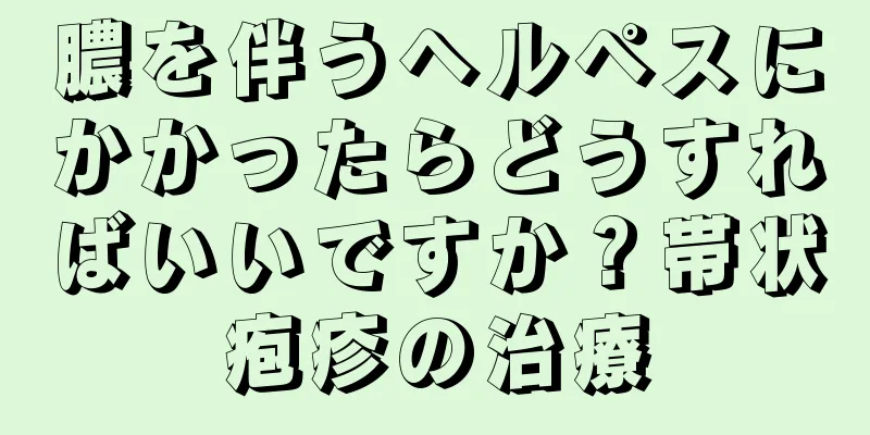 膿を伴うヘルペスにかかったらどうすればいいですか？帯状疱疹の治療