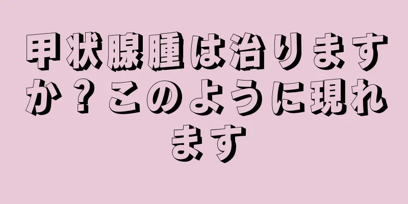 甲状腺腫は治りますか？このように現れます