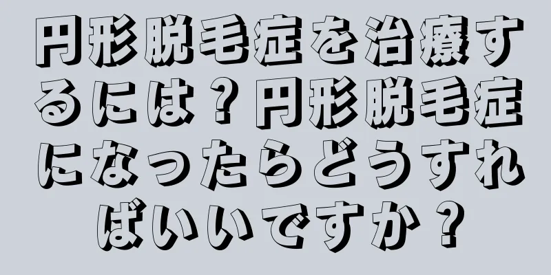 円形脱毛症を治療するには？円形脱毛症になったらどうすればいいですか？