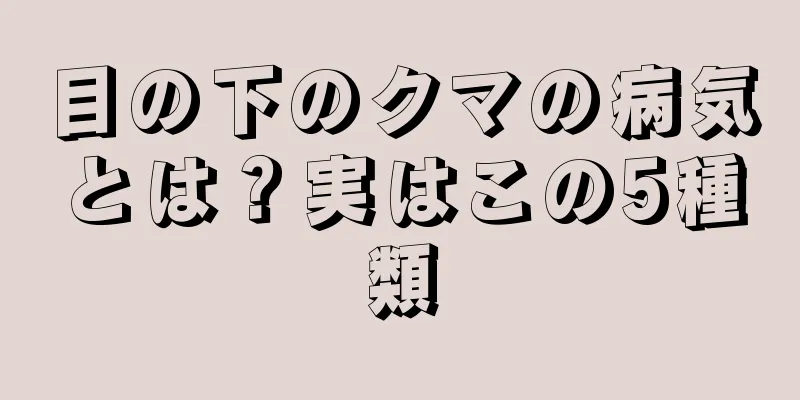 目の下のクマの病気とは？実はこの5種類