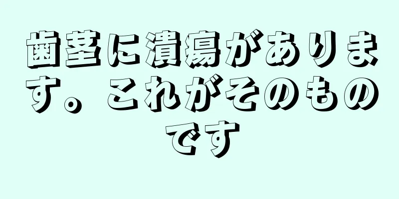 歯茎に潰瘍があります。これがそのものです