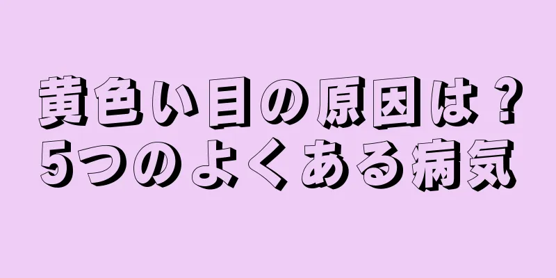 黄色い目の原因は？5つのよくある病気