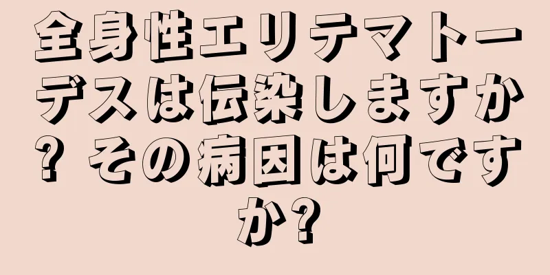 全身性エリテマトーデスは伝染しますか? その病因は何ですか?