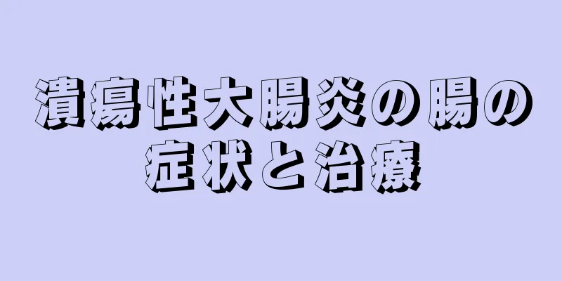 潰瘍性大腸炎の腸の症状と治療