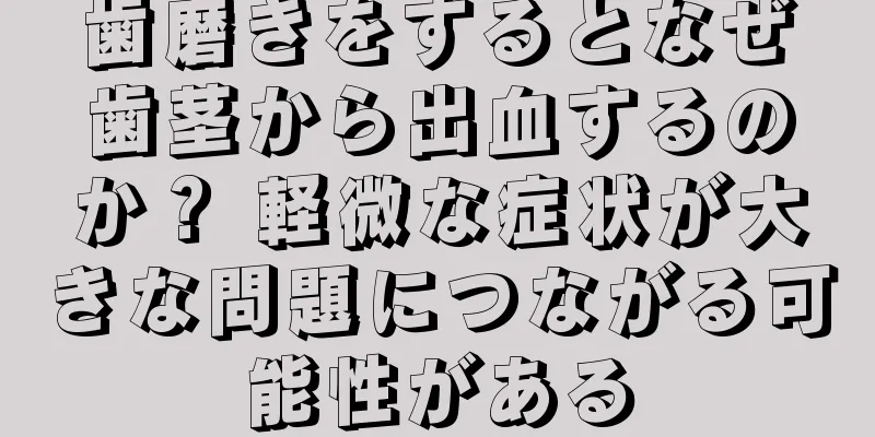 歯磨きをするとなぜ歯茎から出血するのか？ 軽微な症状が大きな問題につながる可能性がある