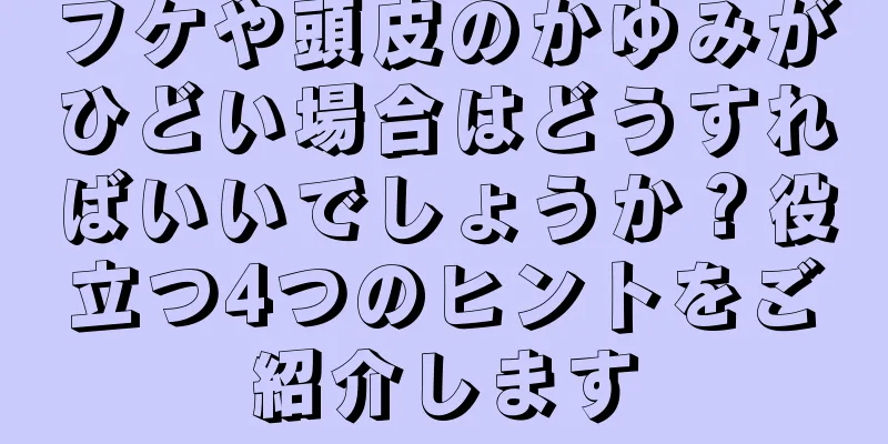 フケや頭皮のかゆみがひどい場合はどうすればいいでしょうか？役立つ4つのヒントをご紹介します