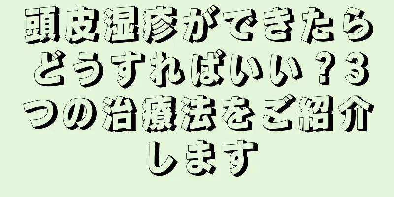 頭皮湿疹ができたらどうすればいい？3つの治療法をご紹介します