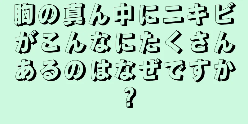 胸の真ん中にニキビがこんなにたくさんあるのはなぜですか？