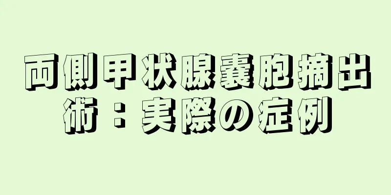 両側甲状腺嚢胞摘出術：実際の症例