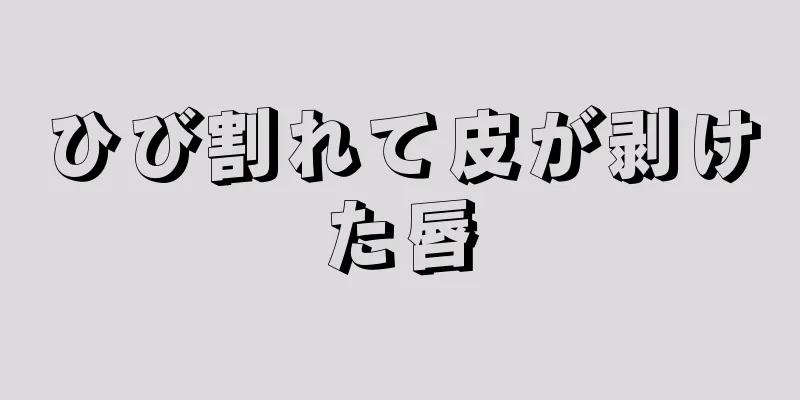 ひび割れて皮が剥けた唇